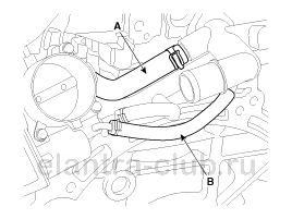 2. Узел контроля температуры воды. Снятие и установка Hyundai Elantra AD