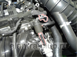 3. Проверка технического состояния Hyundai Elantra AD