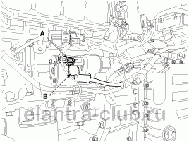 5. Снятие и установка Hyundai Elantra AD