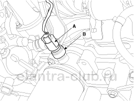 6. Датчик давления масла. Снятие и установка Hyundai Elantra AD